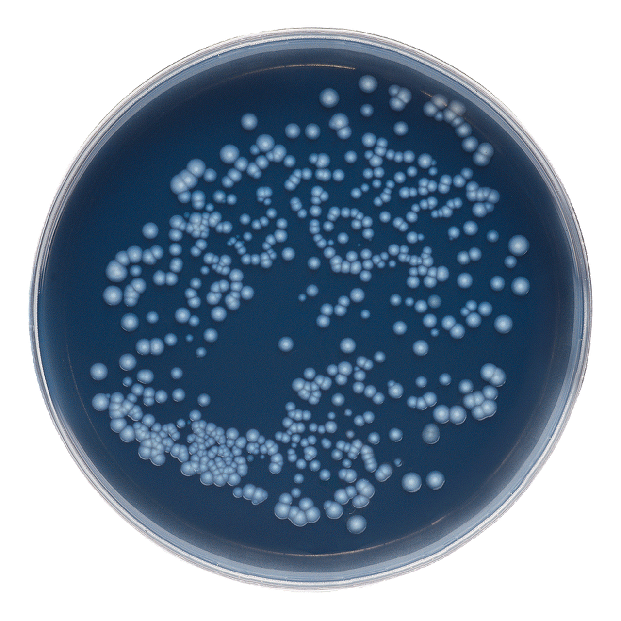 Analisi legionella